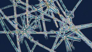 Phytoplankton with diatoms Asterionella formosa and algaes. Image: Roland Birke/Getty