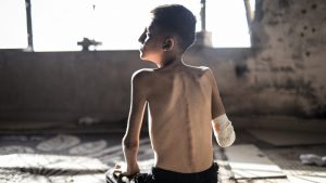 Ahmad Falih Versh Agha, a 14-year-old boy living in a shelter on Rashid Street, west of Gaza City, who was seriously wounded in the attack on his school. Photo: Ahmed Jihad Ibrahim Al-arini/Anadolu via Getty Images