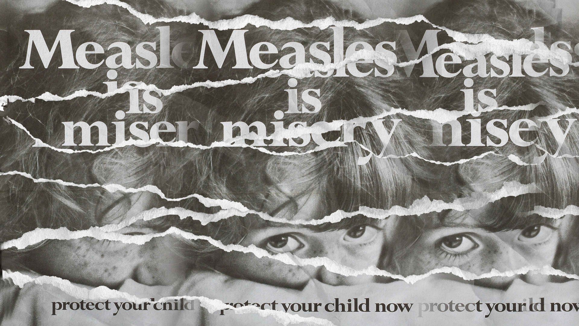 Measles: The return of a killer